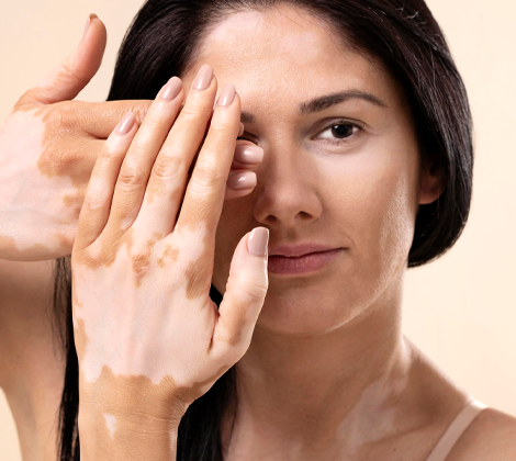 Hydrafacial